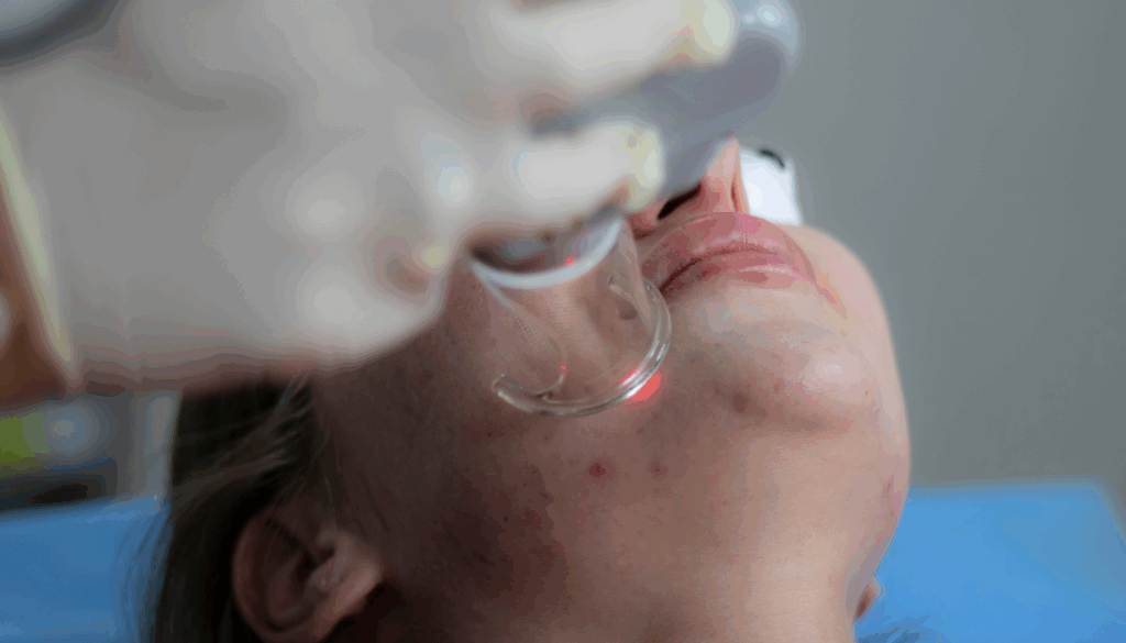 dermatologue qui passe un laser sur le visage d'une personne avec de l'acné